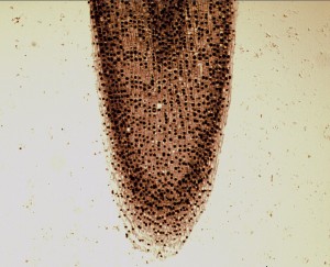 Onion root tip under a microscope. The dark staining globs in the cells are chromosomes going through the steps of division to make the root tip grow. Photograph by John Alan Elson.